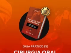 O Guia Prático de Cirurgia Oral Funciona? Sim, o Guia Prático de Cirurgia Oral funciona. Esse livro foi escrito para você que quer ser um cirurgião extraordinário, para você que não se contenta com o trivial, com o básico, com o "normal", para você que acredita que o seu paciente merece o melhor e mais completo entendimento sobre o seu tratamento, para você que quer fazer a diferença na história da Odontologia, e não quer simplesmente ser mais um profissional nesse mercado extremamente saturado e competitivo. O Guia Prático de Cirurgia Oral Vale a Pena? Sim, o Guia Prático de Cirurgia Oral vale a pena. Se você já tomou a decisão de vencer e quer ser um exímio cirurgião: essa obra chegou às mãos certas. O que você carrega agora é algo que nós - nem ninguém no mundo - nunca teve. Esse livro é resultado de anos de estudo, de incotáveis horas de fotografia e meses e meses de escrita. Isso tudo para você ter o melhor conteúdo cirúrgico de maneira completa, simplificada, direta e extremamente bem ilustrada. Você perceberá que abordamos o conteúdo cirúrgico desde os princípios de anamnese e semiologia, até a biologia básica dos processos cicatriciais, incluindo uma base de farmacologia para prescrição segura e racional. Dissecamos os detalhes dos instrumentais cirúrgicos, explicando a mecânica, a nomenclatura, o uso e as técnicas. Para quem o Guia Prático de Cirurgia Oral é Bom? Cirurgiões dentistas Profissionais da Odontologia Indivíduos que buscam excelência em sua prática cirúrgica Aqueles que rejeitam a mediocridade e almejam a excelência Pessoas que desejam oferecer o melhor e mais completo tratamento aos pacientes Indivíduos que aspiram fazer a diferença na história da Odontologia Profissionais que não querem se contentar em ser apenas mais um em um mercado saturado e competitivo Pessoas comprometidas em se tornarem cirurgiões de destaque Indivíduos que desejam aprimorar seus conhecimentos em anamnese, semiologia, biologia dos processos cicatriciais e farmacologia cirúrgica Cirurgiões dentistas interessados em aprofundar seu entendimento sobre os instrumentais cirúrgicos e suas técnicas de uso.