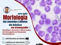 O Curso Morfologia das Leucemias e Linfomas Funciona? Sim, o Curso Morfologia das Leucemias e Linfomas funciona. No vasto campo da hematologia, a interpretação precisa dos resultados de mielogramas e hemogramas é crucial para o diagnóstico e tratamento eficazes de uma variedade de condições, desde leucemias agudas até outras neoplasias hematológicas. Entretanto, compreender e interpretar adequadamente os achados morfológicos presentes nessas análises pode ser desafiador e requer conhecimento especializado. O Curso Morfologia das Leucemias e Linfomas Vale a Pena? Sim, o Curso Morfologia das Leucemias e Linfomas vale a pena. Desenvolvido por especialistas renomados no campo da hematologia, este curso oferece uma oportunidade única para profissionais da saúde aprimorarem suas habilidades na interpretação de resultados hematológicos, especialmente aqueles relacionados às leucemias agudas, leucemias crônicas, mieloma, linfomas e outras neoplasias hematológicas. Para quem o Curso Morfologia das Leucemias e Linfomas é Bom? Hematologistas. Patologistas. Médicos residentes em hematologia ou patologia. Enfermeiros especializados em hematologia. Técnicos de laboratório com foco em hematologia. Estudantes de medicina interessados em hematologia ou patologia.